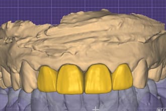 design bridges, implant prosthesis and all on x