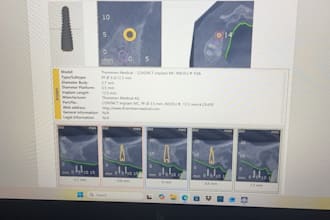design high precision exocad cad cam dental crowns bridges