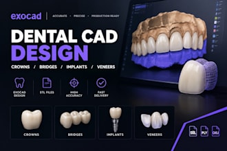 design dental cad crowns bridges implants and veneers in exocad