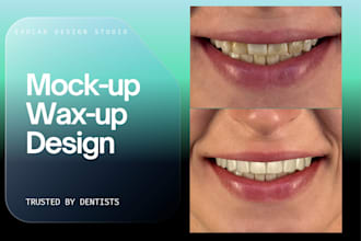 design digital mockups and wax ups in exocad