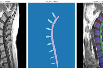 do medical image annotation and segmentation for mri ct and x ray