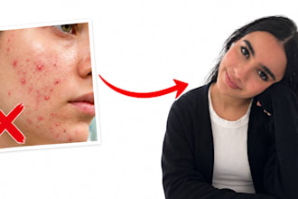 be your personal skincare coach for acne prone skin