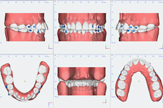 teach you onyxceph clear aligner treatment planning