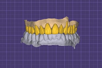 design dental cad crowns, bridges, and implants in exocad or 3shape