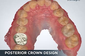 design anterior and posterior dental crowns using 3shape