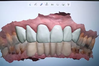 design dental crowns and bridges using 3shape dental system