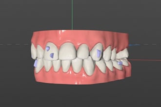 design complete clear aligner treatment plans