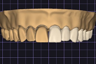 make dental crown design on prepared tooth for you
