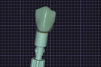 make your dental implant crown design