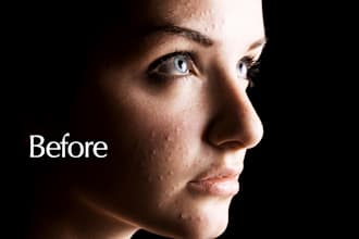 remove acne and blemishes from photos