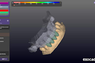 create accurate dental prosthesis designs using exocad