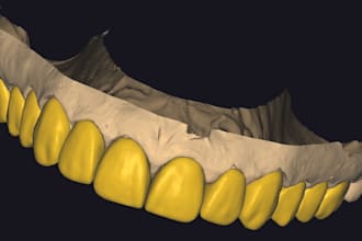 design a dental mock up design using exocad