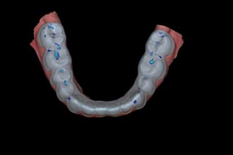 design a custom dental michigan night guard