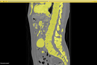 do ct and mri scans segmentation using 3d slicer