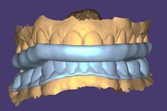 do dental cad design for splints in exocad