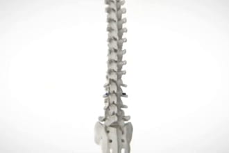 create 3d medical animation, 3d medical device animation, 3d surgical animation