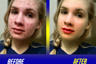 do image editing related works