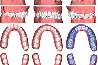 treatment plan your clear aligner high quality setups