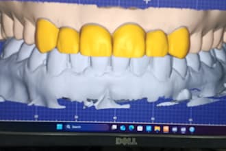 design teeth in exocade