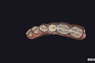 design fast , remake safe , biomechanically sound restorations on exocad