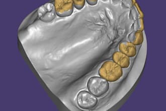 design implant crowns, bridges and waxup in exocad with 11 years exp