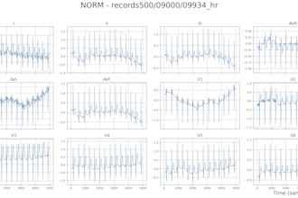 create interactive data visualizations and ml plots using python