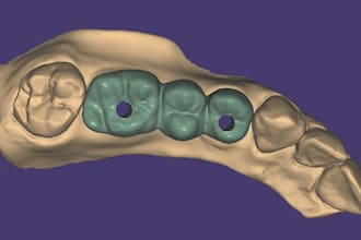 design dental crowns ,bridges ,implant and veneer cases