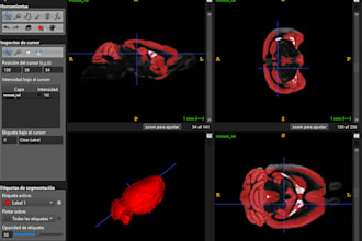 segment and analyze ct and mri medical images in imagej