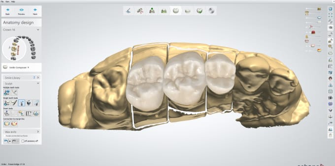 Bestseller - design dental crowns,bridges,veneers in 3shape