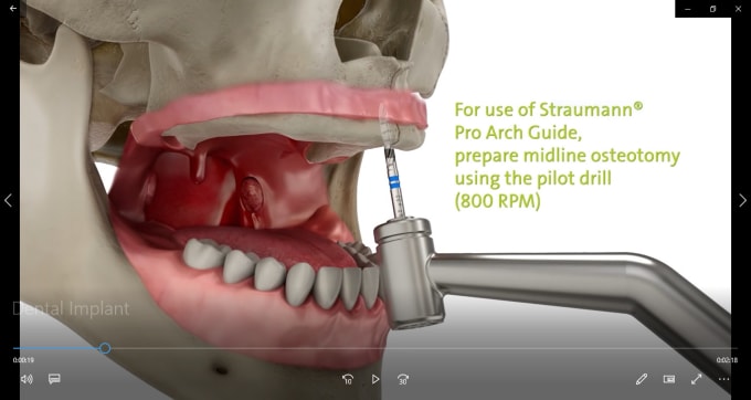 Gig Preview - Make dental 4d animated videos