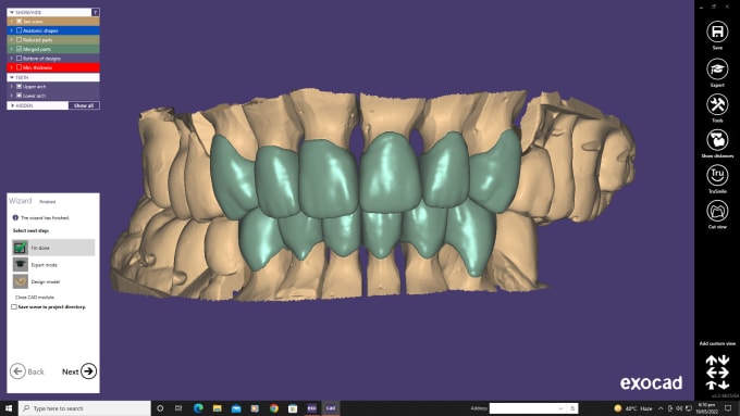 Gig Preview - Design crown bridge and dental restorations in exocad