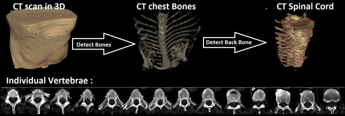 Gig Preview - Automate medical image processing