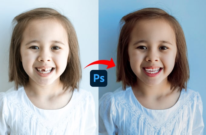 Gig Preview - Edit your teeth, align, whiten teeth, and remove braces in photoshop fast