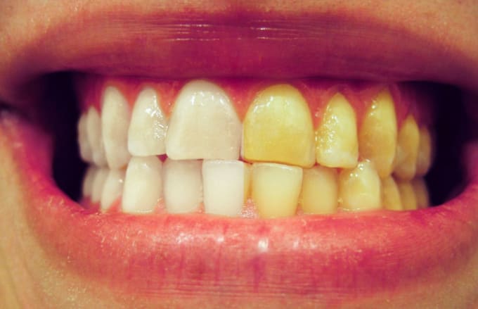 Gig Preview - Whiten teeth in photoshop in 2 hours