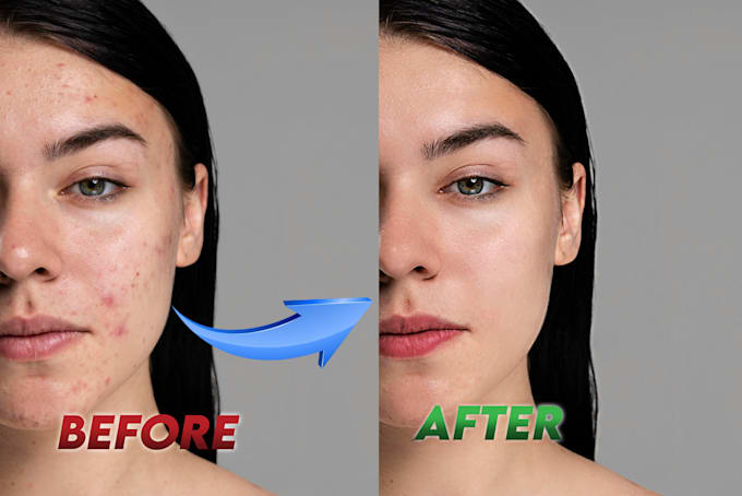 Gig Preview - Remove scars, spots, marks, pimples, clear headshots, portraits using ps