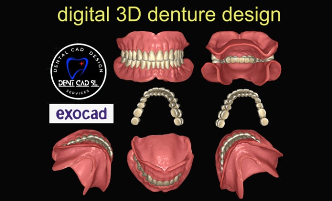 Gig Preview - Design high quality dentures using exocad