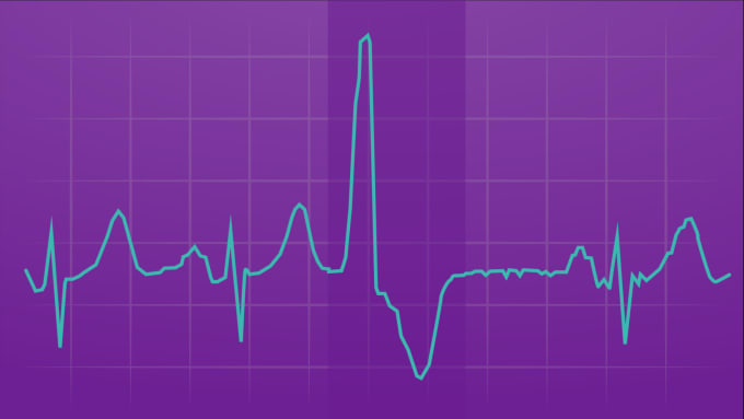 Bestseller - interpret any ecg and teach ecg interpretation