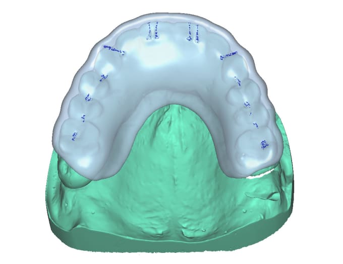 Bestseller - design expert dental cad cam works