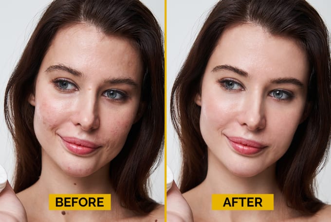 Gig Preview - Remove wrinkles, pimples and retouch skin in photoshop