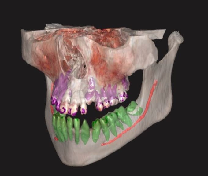 Gig Preview - Convert medical images to medical 3d model