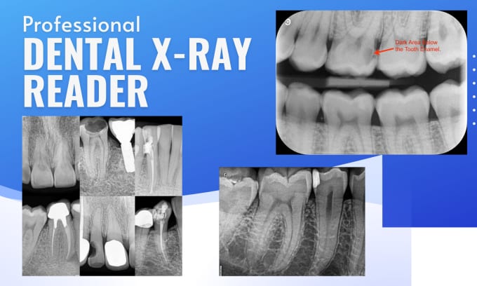 Bestseller - read your dental x rays