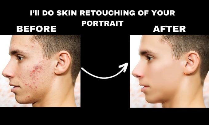 Gig Preview - Remove wrinkles, pimples and retouch skin in photoshop