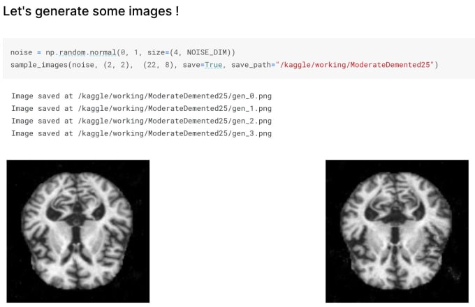 Gig Preview - Image augmentation by generative adversarial networks gan