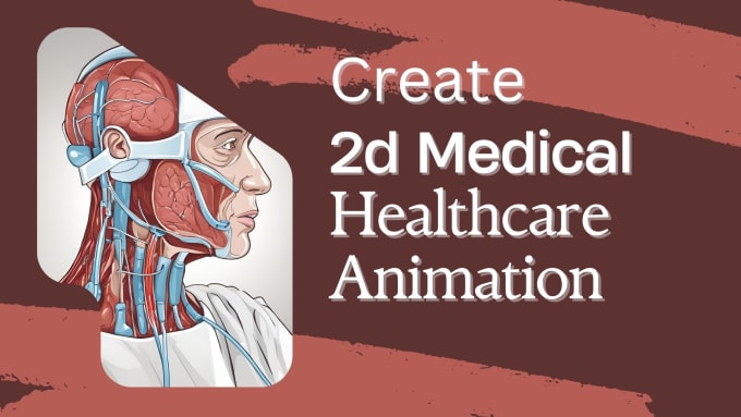 Gig Preview - Create a medical science and surgical 2d animated  video