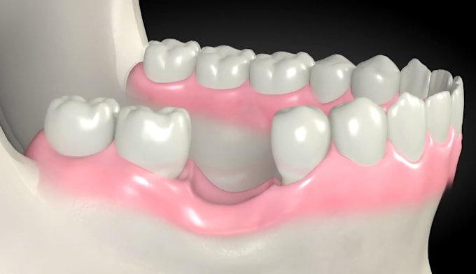 Gig Preview - Do 3d medical animation dental surgery animation medical animation 3d animation