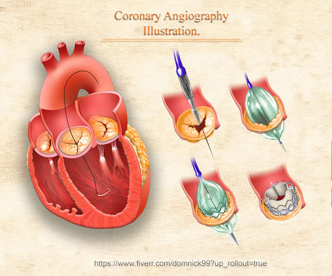 Gig Preview - Do medical anatomy, illustration and diagram for you