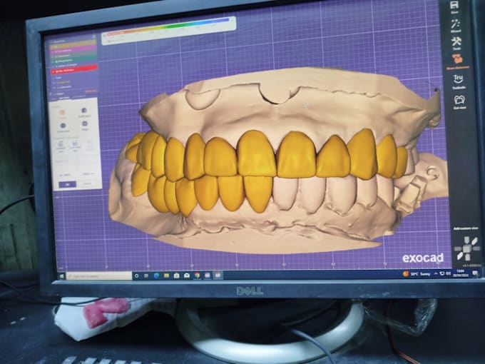 Gig Preview - Handle every solutions related to digital dentistry