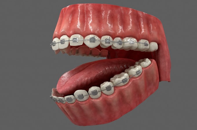 Gig Preview - Do high quality 3d medical animation, 3d dental animation, surgery video in HD