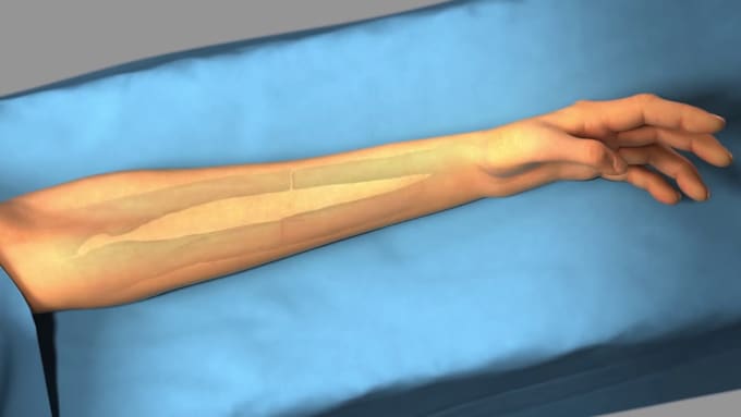 Gig Preview - Create high quality 3d medical animation, surgery animation in HD rendering