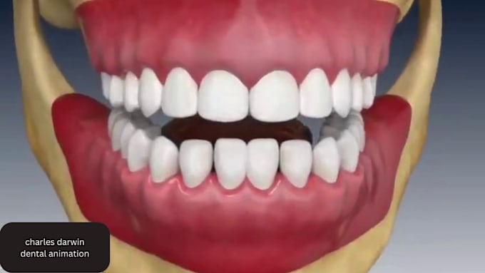 Gig Preview - Do 3d dental animation, 3d medical explainer video and surgery animation process